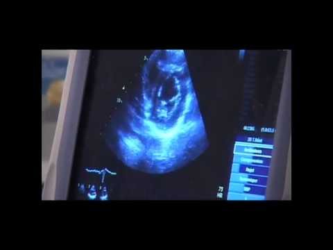 BHC - L'échographie transthoracique