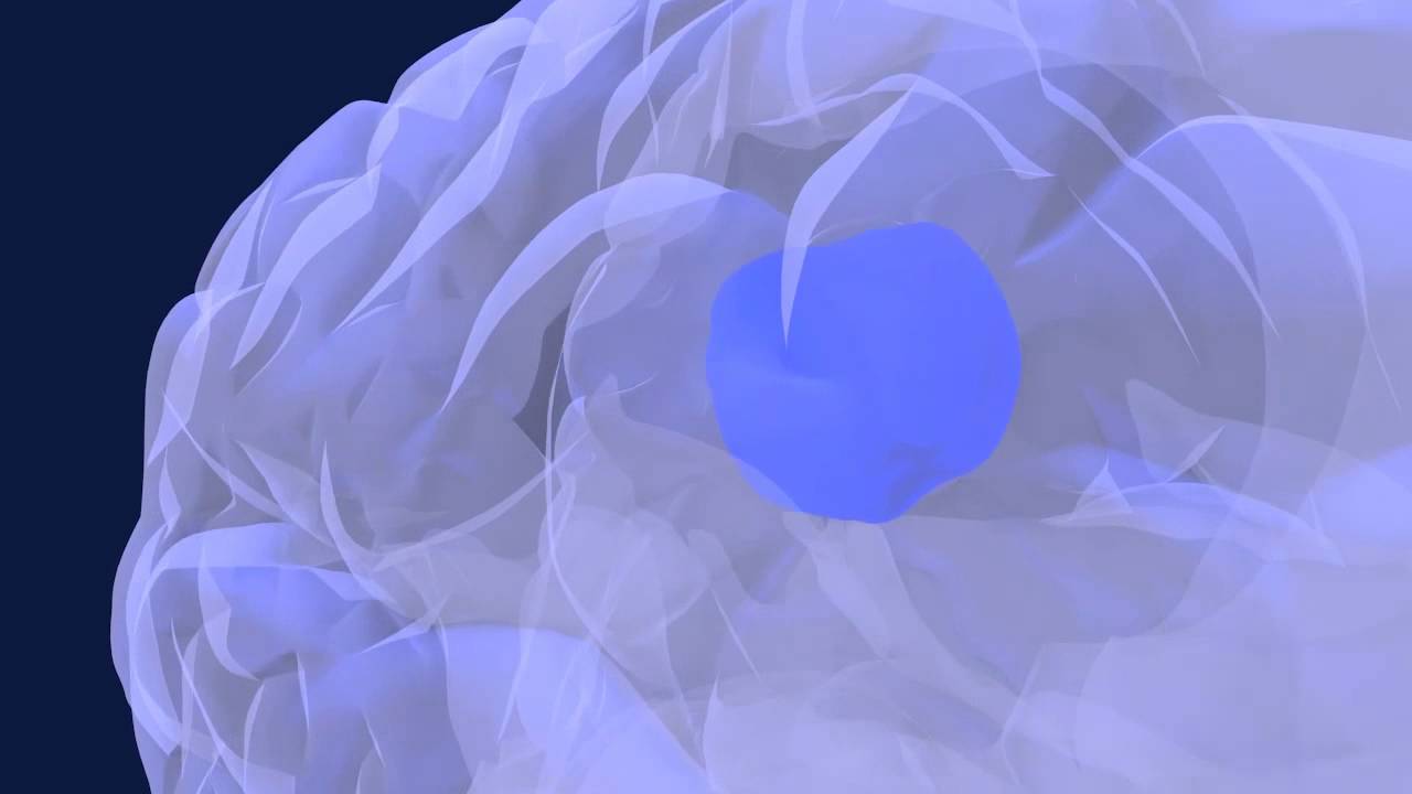 SonoCloud-1 Animation - French Subtitles