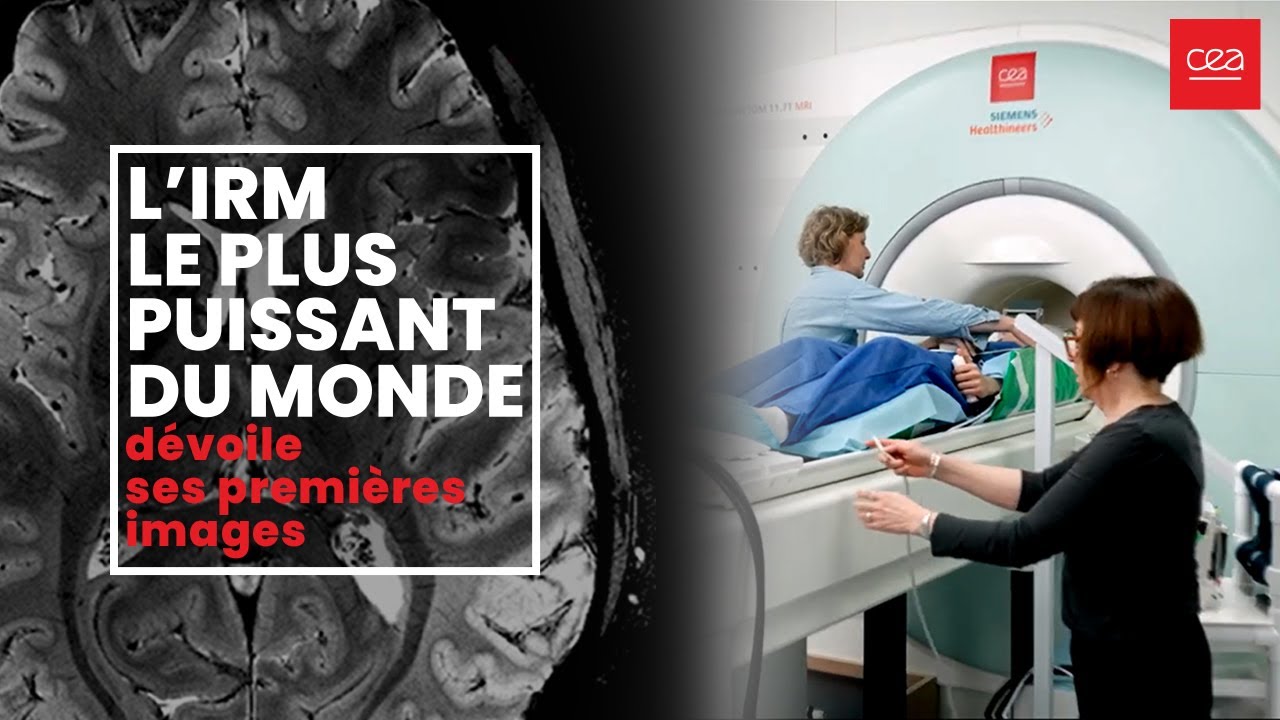 🧠[Première mondiale] Le cerveau dévoilé comme jamais grâce à l’IRM le plus puissant au monde