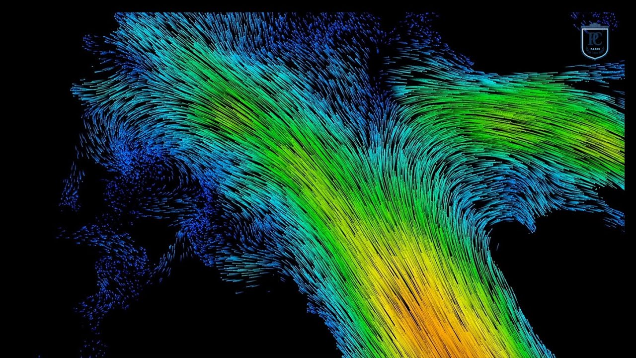 La vascularisation du cerveau détaillée observée par ultrasons