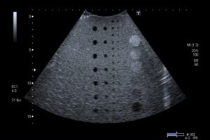Cristaux d'une sonde 2D fonctionnels