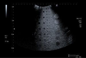 Cristaux d'une sonde 2D endommagés