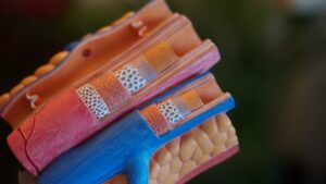 sonde échographique